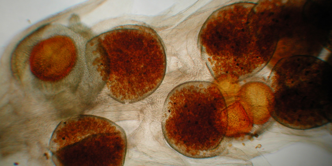 Microspores and Megaspores of Selaginella