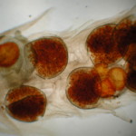 Microspores and Megaspores of Selaginella