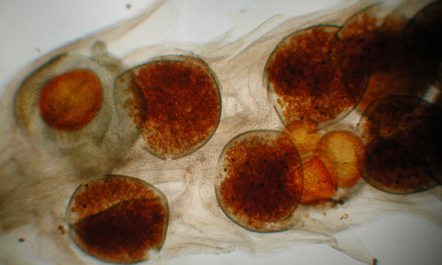 Microspores and Megaspores of Selaginella