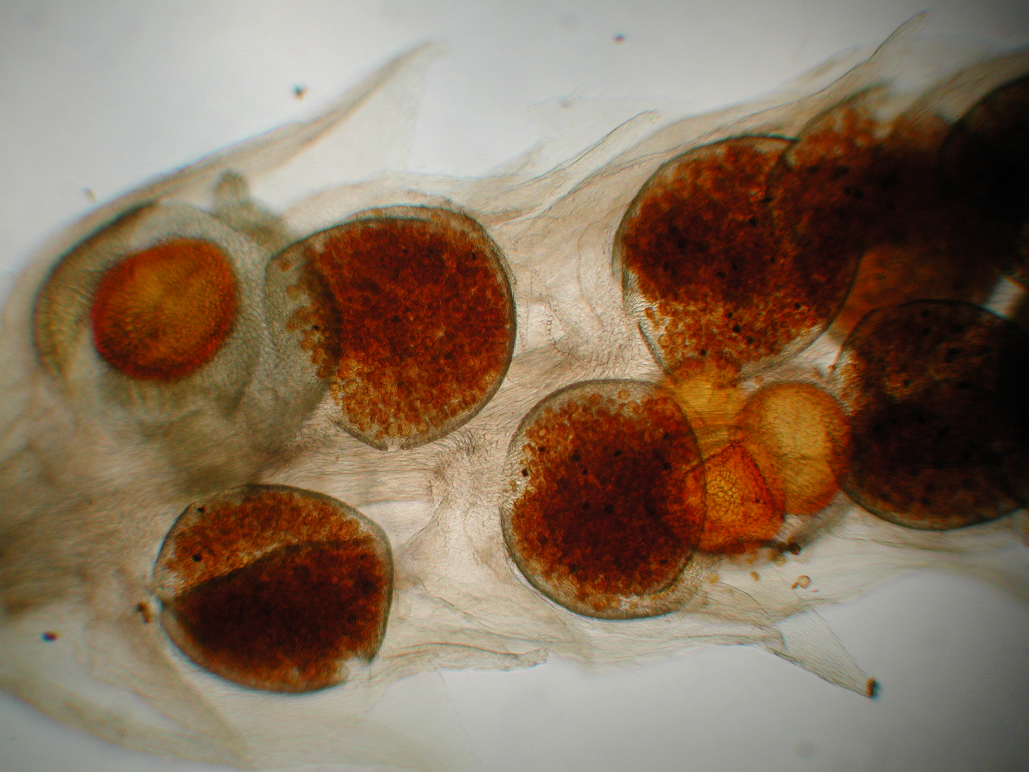 Microspores and Megaspores of Selaginella