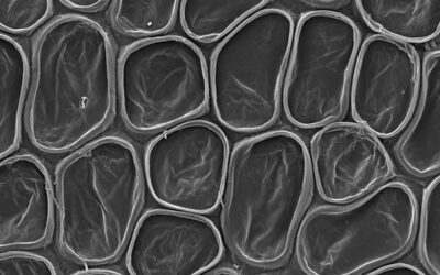 Elaphoglossum lalitae